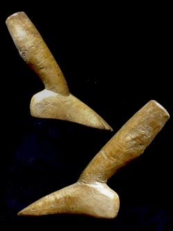 XV 61 Votive of a Deformed Foot